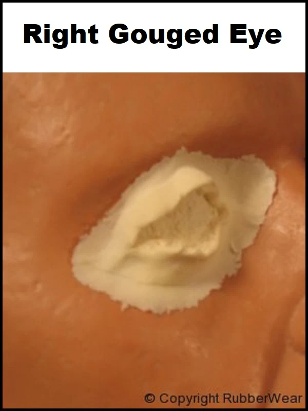 Trauma - Image 19